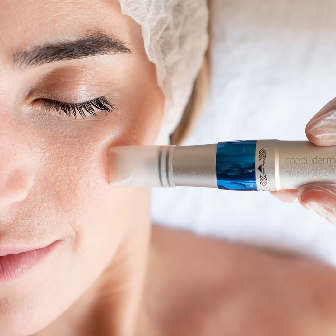 3 sesiones de Nanopore